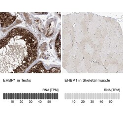 EHBP1 Antibody, Novus Biologicals:Antibodies:Primary Antibodies